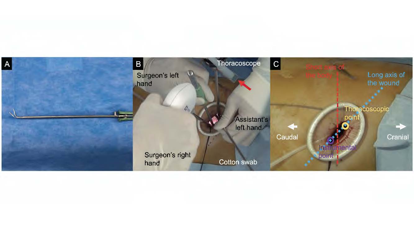 Tips for using forceps during uniportal video-assisted thoracoscopic ...